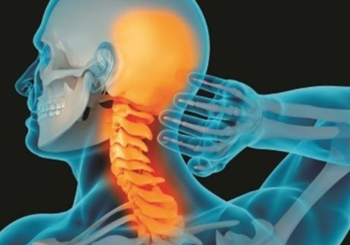 Thoái hóa cột sống cổ: Nguyên nhân, triệu chứng, chẩn đoán và điều trị