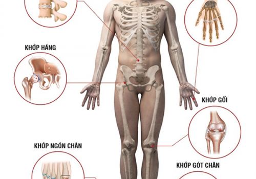 Đau nhức xương khớp ở người trẻ có thể cảnh báo bệnh gì?