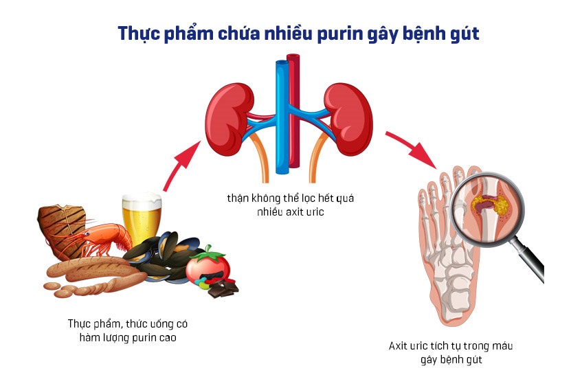 thuc-pham-chua-nhieu-purin